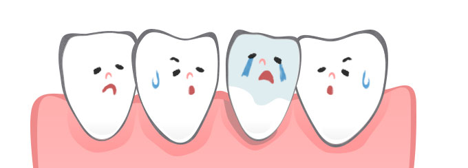 歯間ブラシを使っていたら歯と歯の隙間が広がった気がします