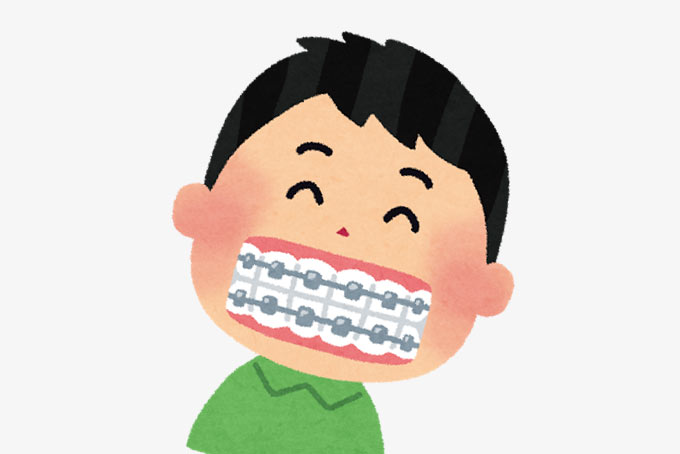 矯正歯科で歯並びを治す少年