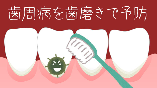 歯周病は歯磨きで予防！プラークの磨き残しを防ぐ方法
