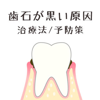 歯石が黒い原因と治療方法/重度だと手術が必要な場合も！